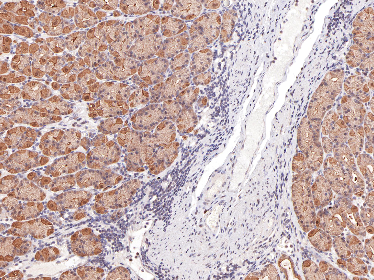 Anti-Survivin Monoclonal Antibody (Clone:IHC668)