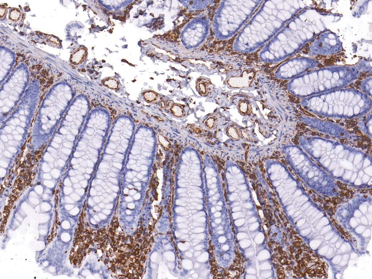 Anti-Vimetin Monoclonal Antibody (Clone:IHC684)-Ready to Use