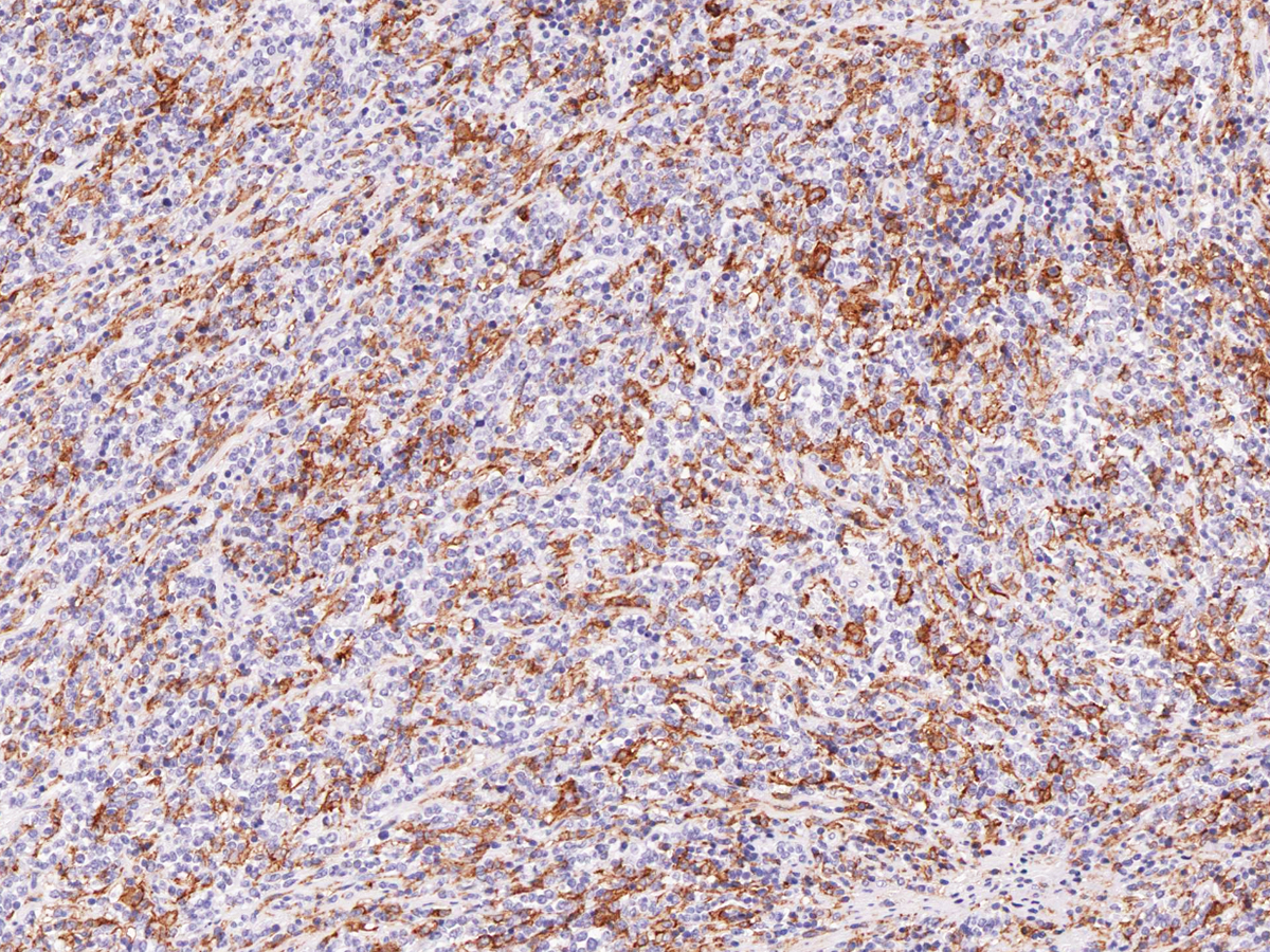 Anti-Hairy Cell Leukemia Monoclonal Antibody (Clone:IHC687)