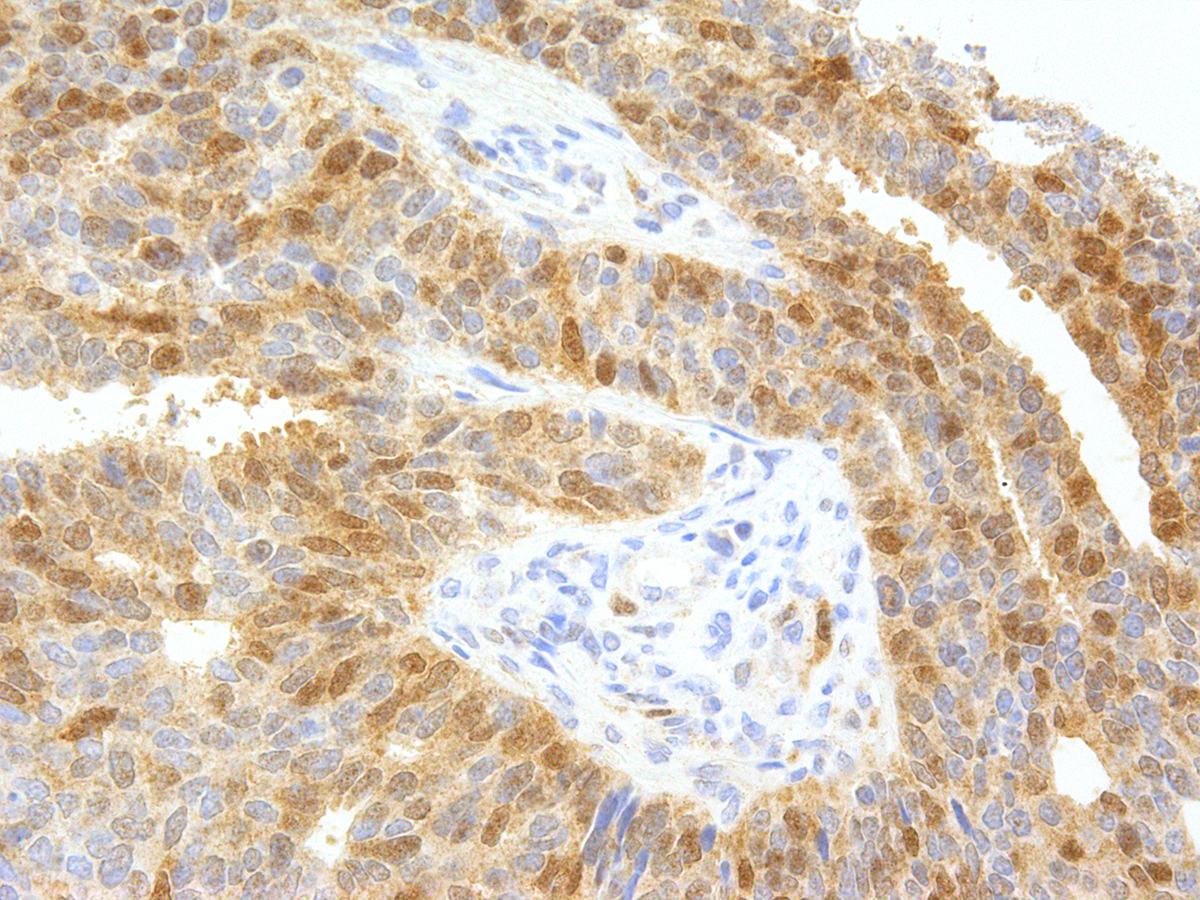 Anti-Thymidylate Synthase Monoclonal Antibody (Clone:IHC697)