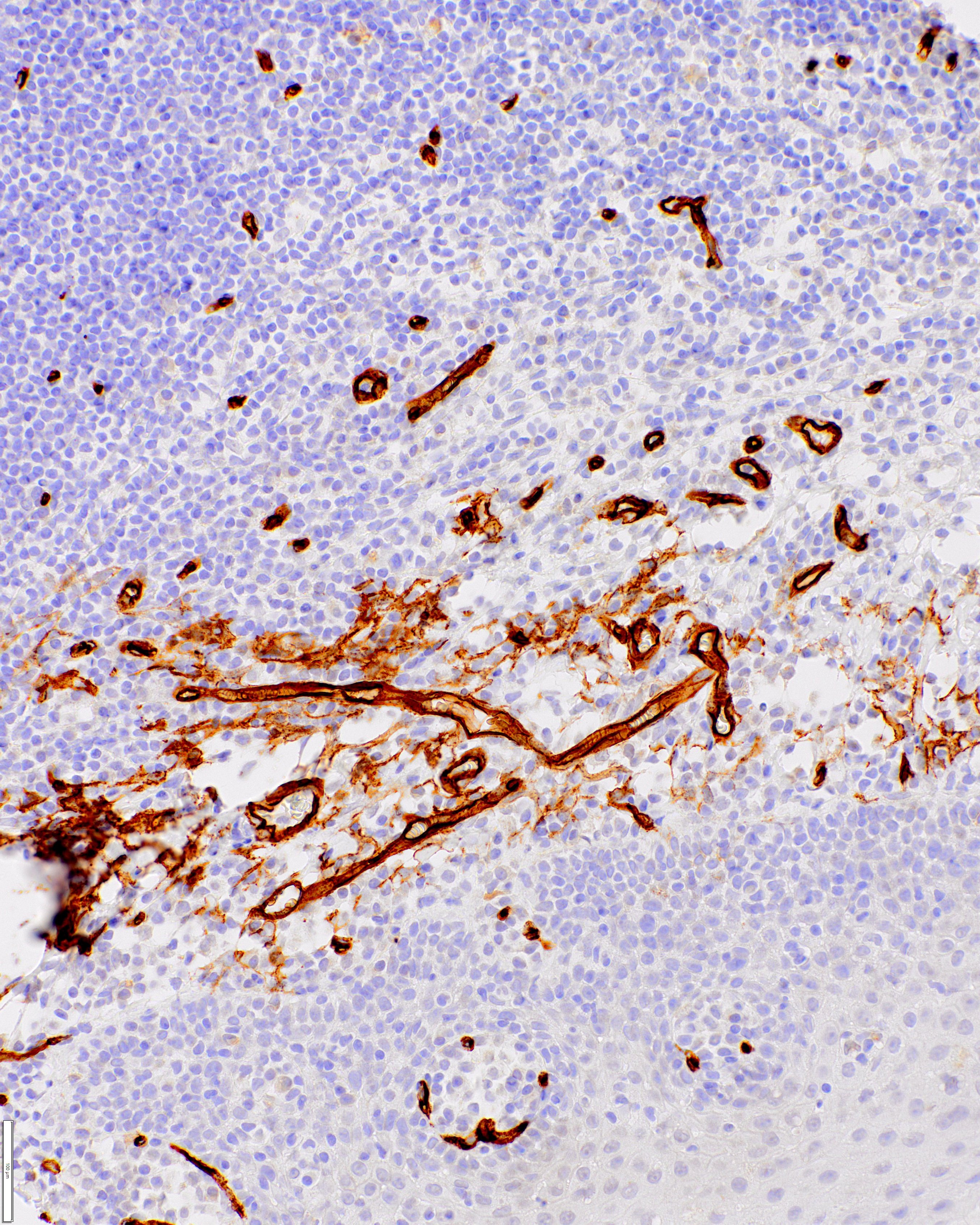 Anti-CD34 Monoclonal Antibody (Clone:IHC034)