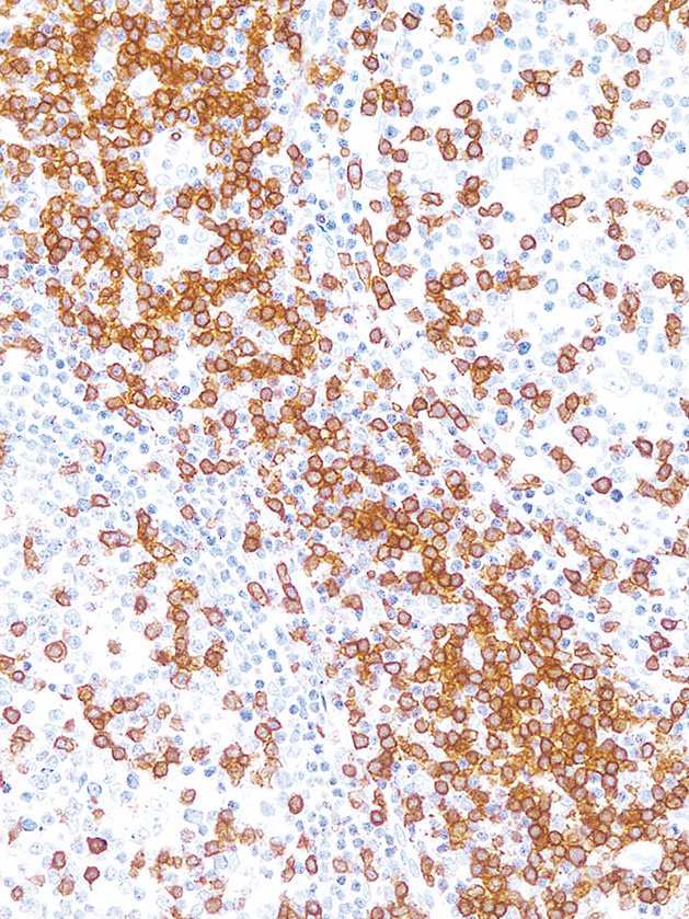 Anti-CD3 Monoclonal Antibody (Clone:IHC534)