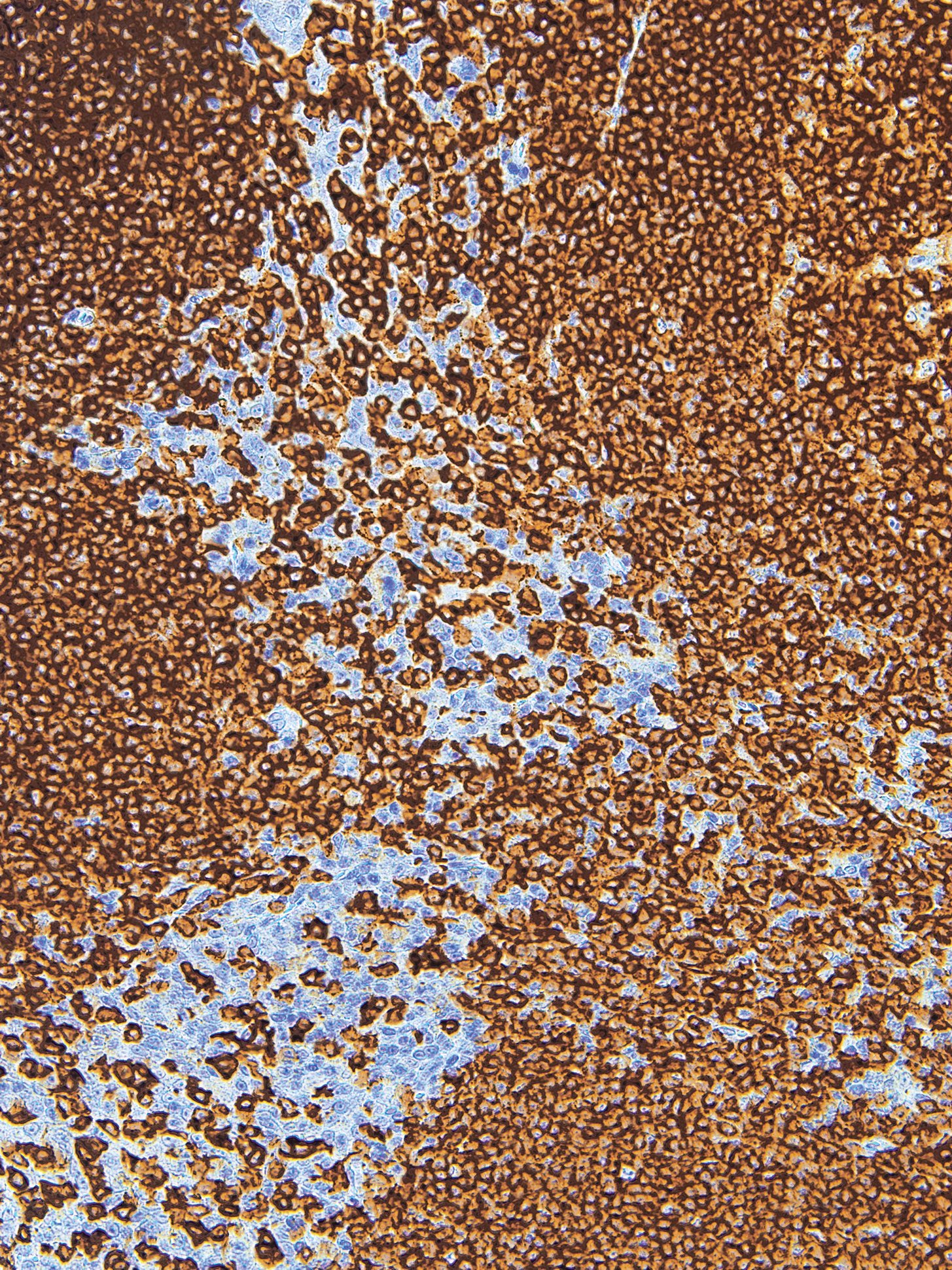 Anti-CD20 Monoclonal Antibody (Clone:IHC532)