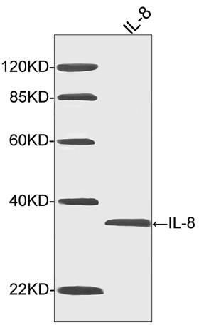 Mouse Monoclonal Antibody to IL-8 (Clone : 1A7C8)(Discontinued)