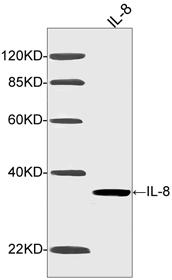 Mouse Monoclonal Antibody to IL-8 (Clone : 4H7C7)(Discontinued)