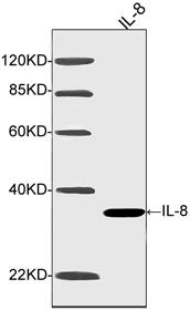 Mouse Monoclonal Antibody to IL-8 (Clone : 4H8F8)(Discontinued)