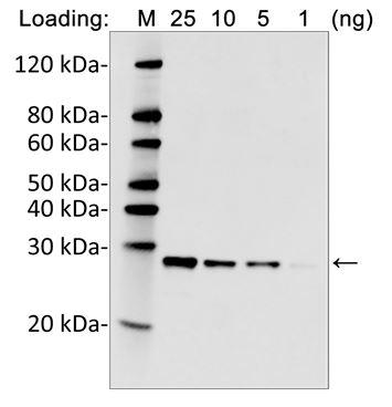 Rabbit Monoclonal Antibody to  His Tag (C-term) (Clone : 25B6E11)