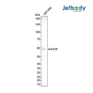 Anti-GFAP VHH antibody